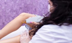 ¿Cómo escoger la mejor depiladora IPL?